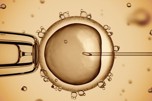 Assisted Reproductive Technology - Egg Donation
